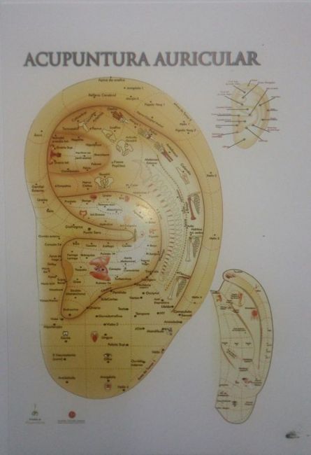 Mapa Auricular